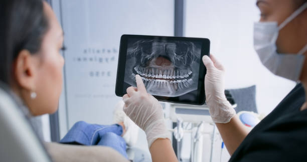 Licensed Teeth Cleaning And Checkup service in Banning, CA - Smile Center Dentistry